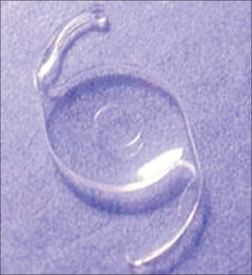 General view of <b>multifocal intraocular lens</b> with gradient <b>optic</b> (photo)